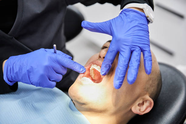 Best Emergency Wisdom Tooth Extraction in Leoti, KS